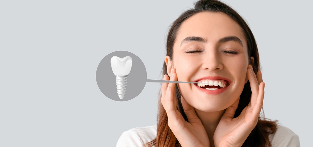 dental implants in lakefield cost process and benefits