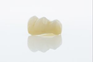 dental crowns in lakefield