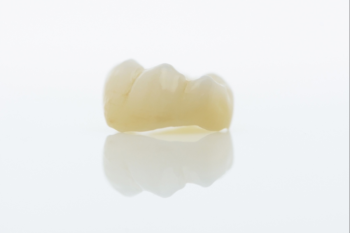 dental crowns in lakefield